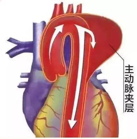 口让 38 岁患者重获新生生死较量！1cm 微创切(图3)